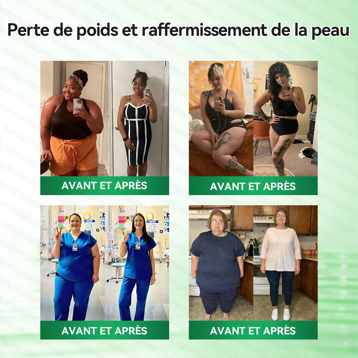 Boutique officielle 🍋‍🟩🍋‍🟩𝐆𝐋𝐎𝐑𝐄𝐍𝐃𝐀® Moringa · Berbérine + NAD+ – Patch Microneedle Nano Avancé 10-en-1 (1×/jour, résultats visibles en 7 jours) | Obésité, relâchement cutané, apnée du sommeil, articulations, etc.-LYJ