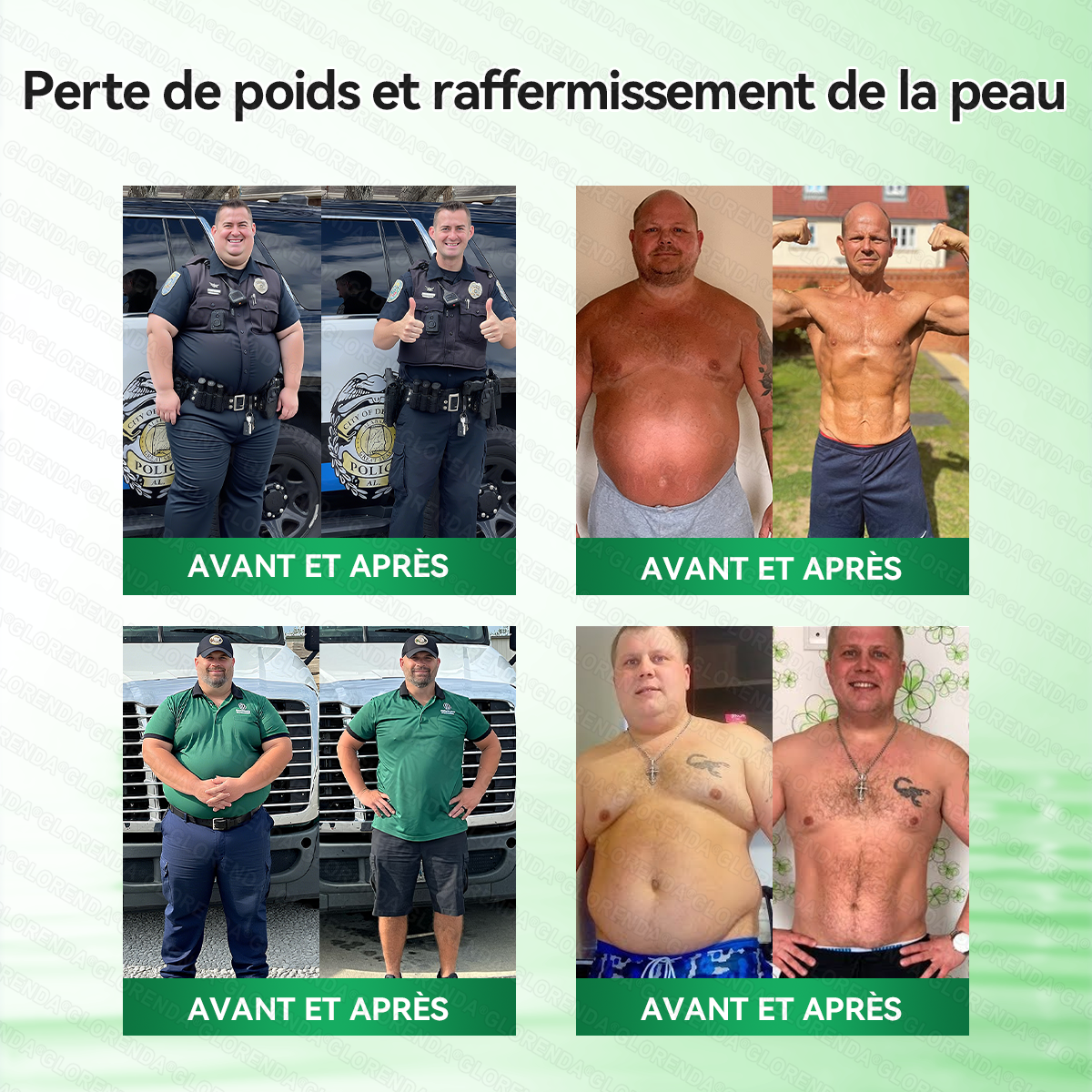 Boutique officielle 🍋‍🟩🍋‍🟩𝐆𝐋𝐎𝐑𝐄𝐍𝐃𝐀® Moringa · Berbérine + NAD+ – Patch Microneedle Nano Avancé 10-en-1 (1×/jour, résultats visibles en 7 jours) | Obésité, relâchement cutané, apnée du sommeil, articulations, etc.-LYJ