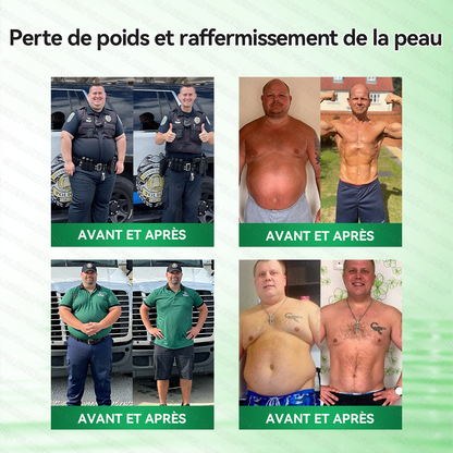 Boutique officielle 🌺🌺𝐆𝐋𝐎𝐑𝐄𝐍𝐃𝐀® Moringa · Berbérine + NAD+ – Patch Microneedle Nano Avancé 10-en-1 (1×/jour, résultats visibles en 7 jours) | Obésité, relâchement cutané, apnée du sommeil, articulations, etc.-LYJ
